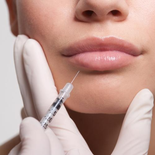 Lip Fillers
